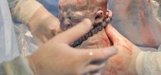 Komórki macierzyste, rewolucja w medycynie. Panaceum na długowieczność?