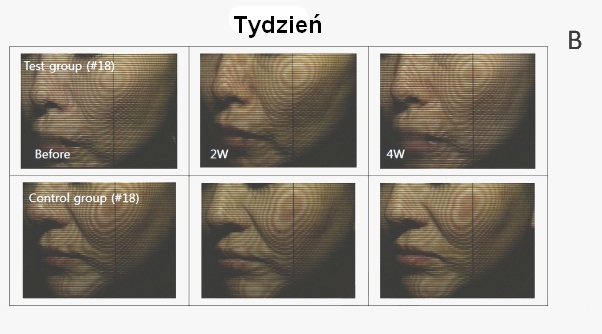 skin3