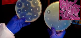 Bezpieczeństwo probiotyków w celu  zapobiegania lub leczenia choroby. Zalety i wady