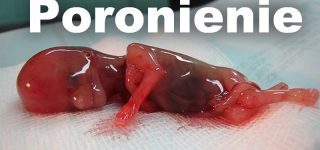 Poronienie – przyczyny genetyczne