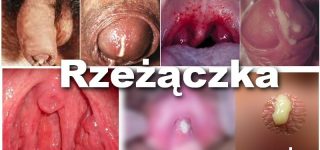 Antybiotyki przestały działać na rzeżączkę
