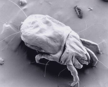Dermatophagoides microceras