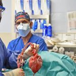 Opublikowano wyniki badań po transplantacji świńskiego serca do człowieka. Serce zrobiło się większe