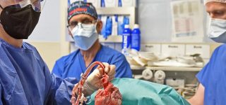 Opublikowano wyniki badań po transplantacji świńskiego serca do człowieka. Serce zrobiło się większe